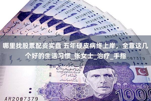 哪里找股票配资实盘 五年硬皮病终上岸，全靠这几个好的生活习惯_张女士_治疗_手指